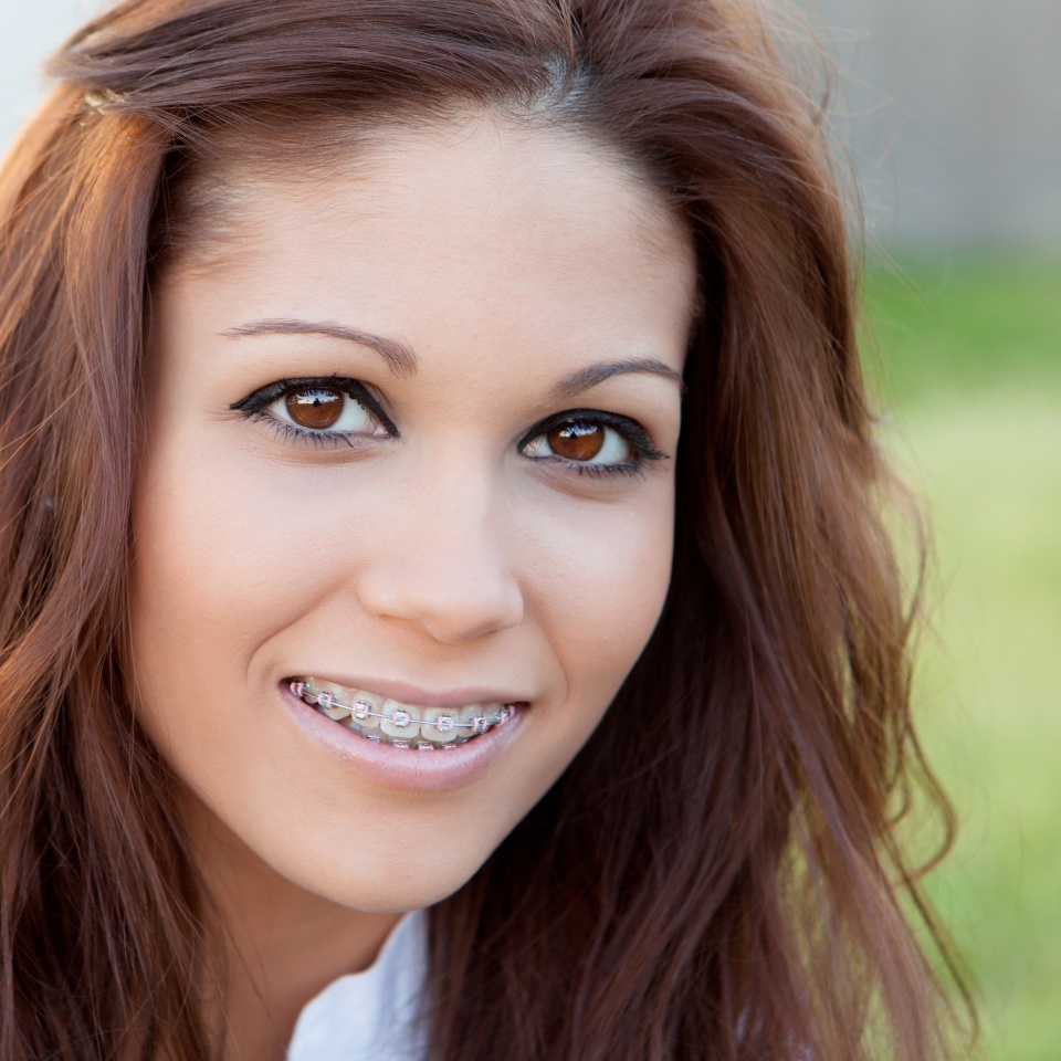 Portrait of a beautiful girl with brackets at the park