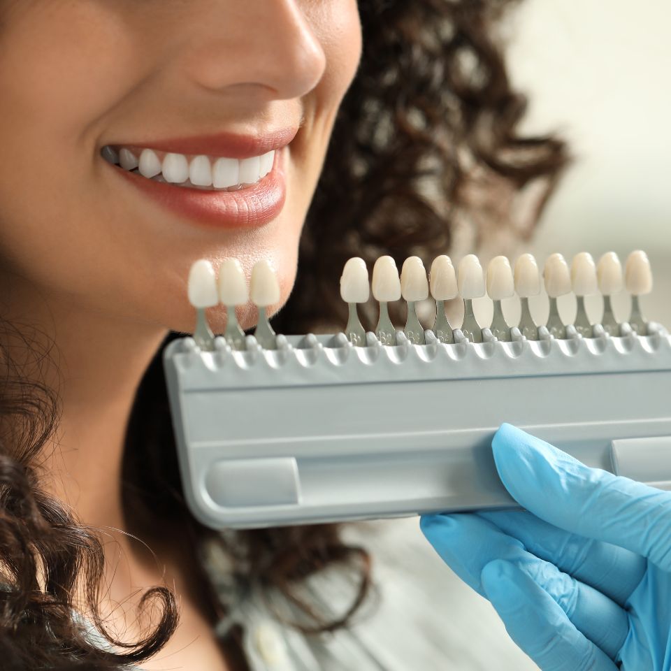 A woman smiles while a gloved hand holds a dental shade guide with various tooth colors next to her teeth.